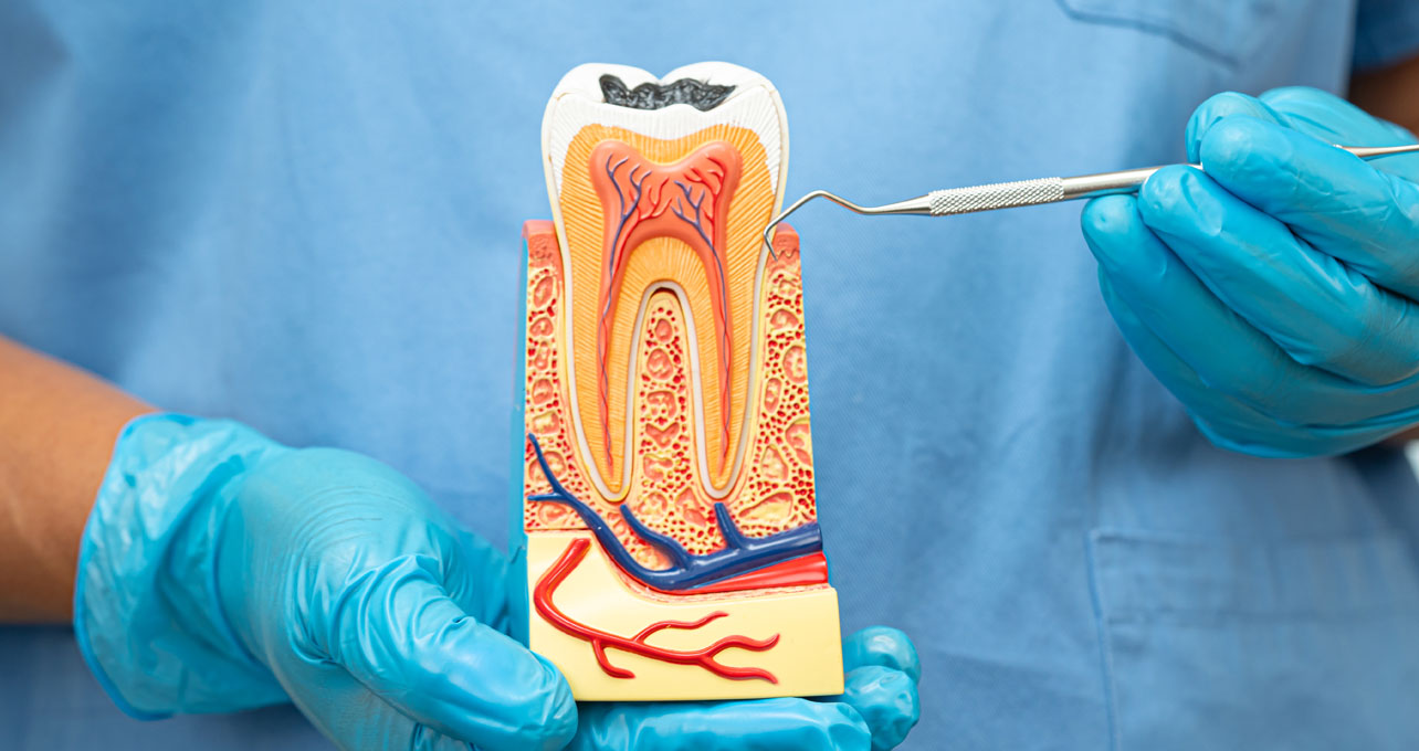 Root Canal Treatments